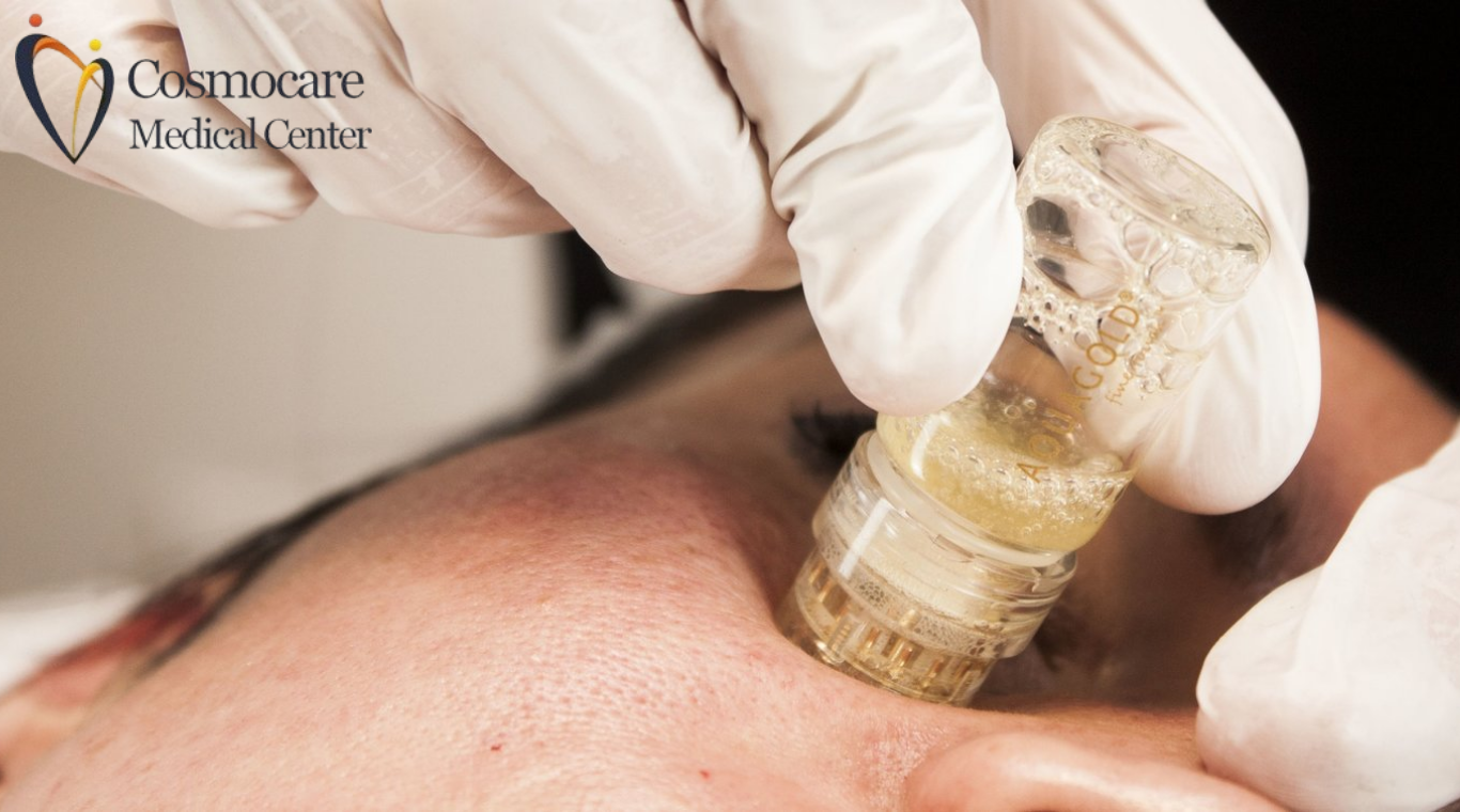 Aqua Gold Facial In Dubai by Cosmocare Medical Center