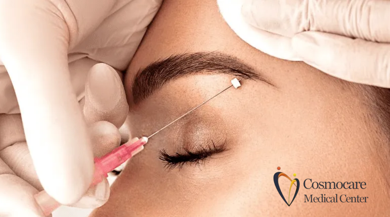 Eyebrow Thread Lifting Treatment in Dubai by Cosmocare Medical Center