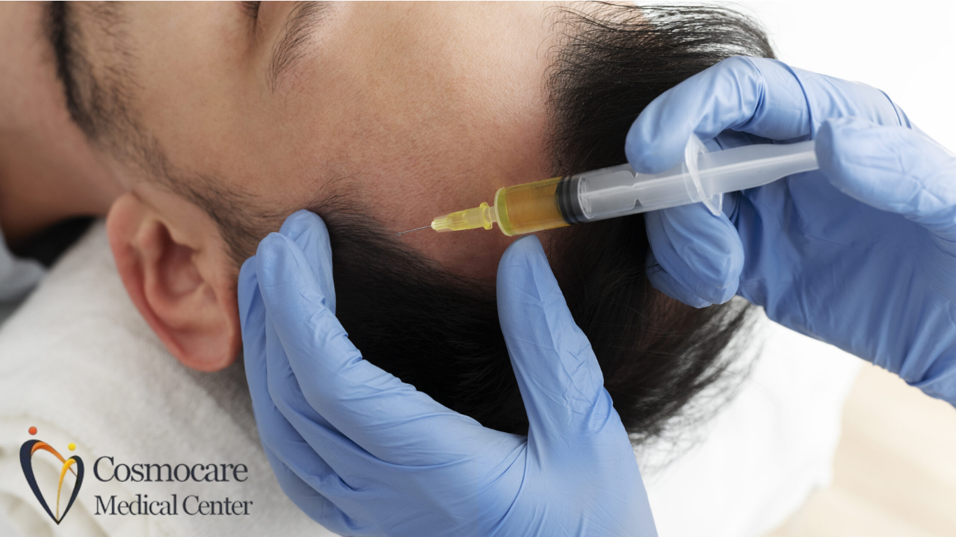 Hair Fall Treatment in Dubai by Cosmocare Medical Center