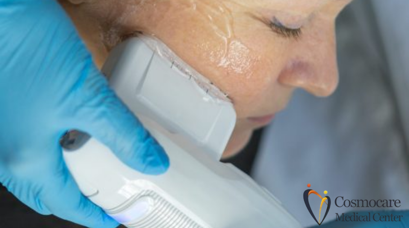 HIFU Non-Surgical Skin Treatment in Dubai by Cosmocare Medical Center