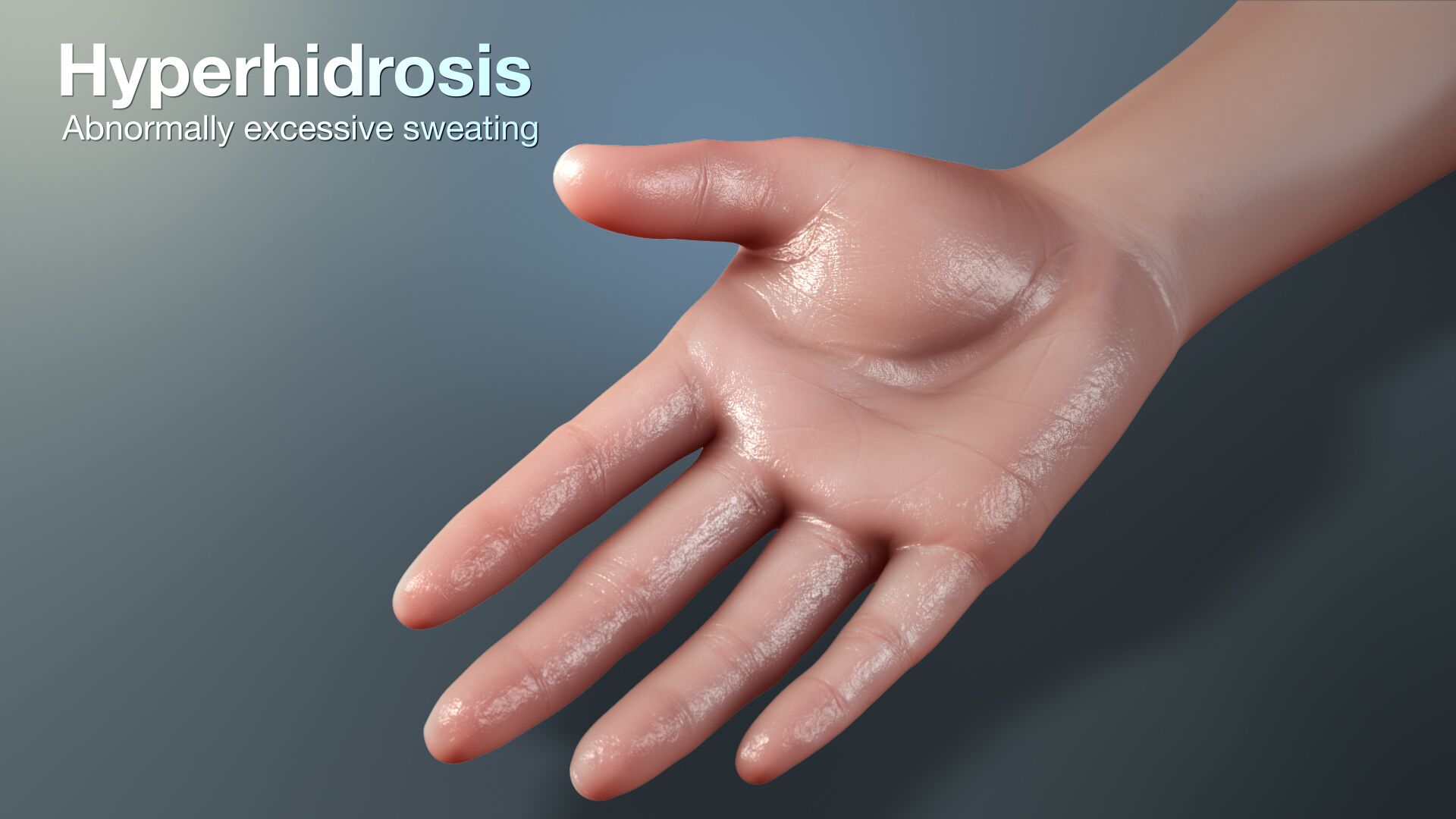 hyperhydrosis excessive sweating dubai