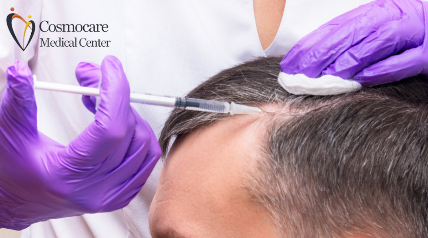 Prf Treatment For Face Hair In Dubai by Cosmocare Medical Center