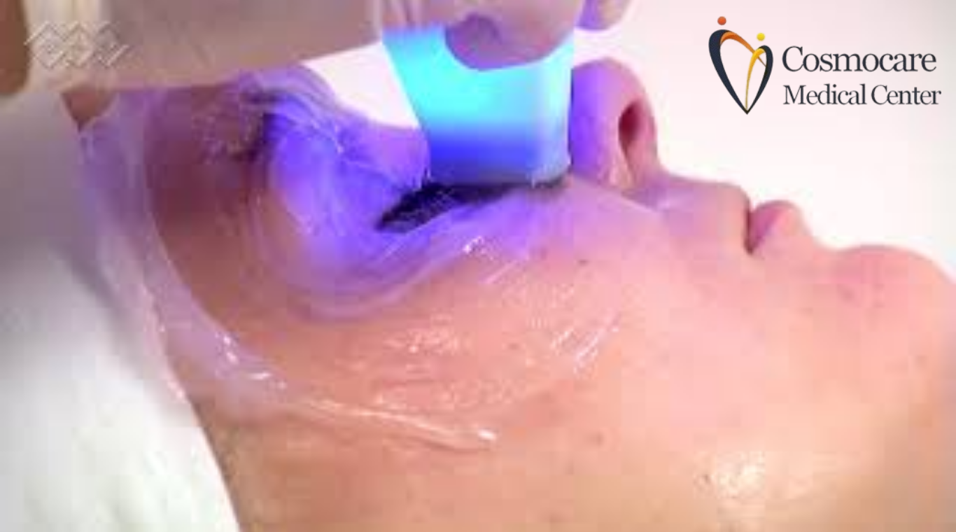 Revolutionary Skin Tightening Fat Reduction With Btl Exilis Ultra in Dubai by Cosmocare Medical Center